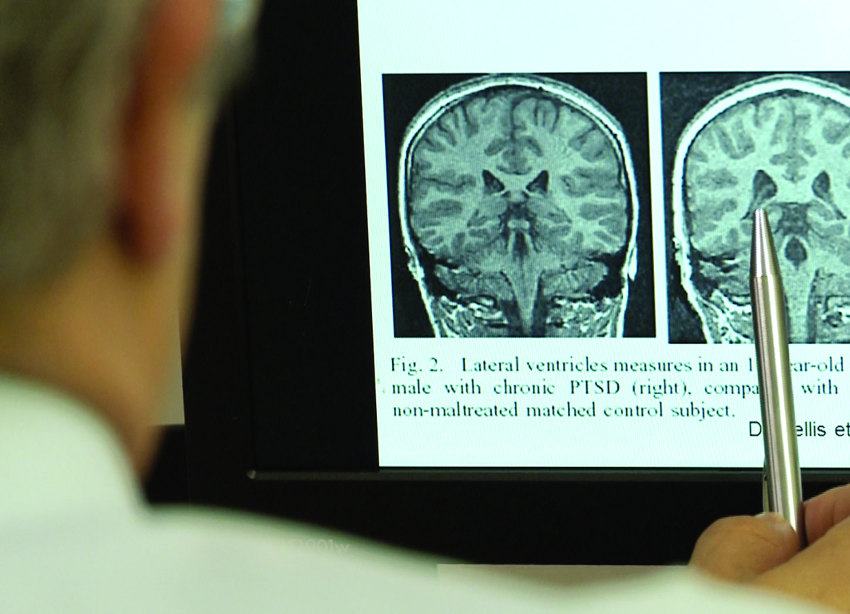 Dr. Christian Kristense explica a atuação do cérebro diante da doença
